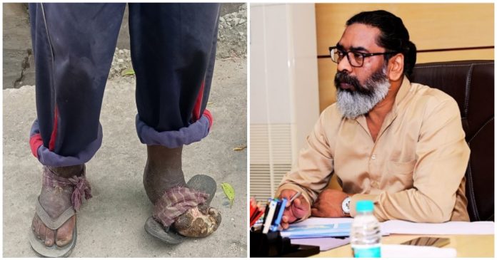 cm hemant soren